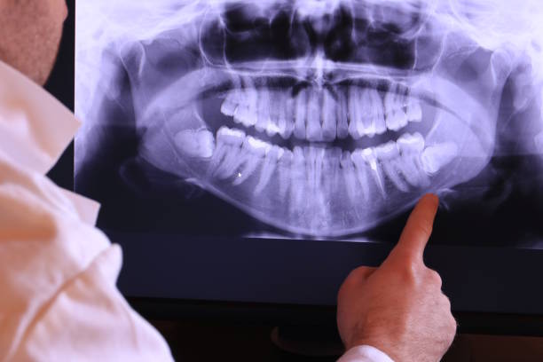 Best Emergency Tooth Extraction in Park City, TN