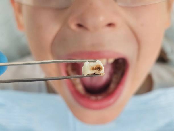 Best Emergency Denture Repair in Park City, TN